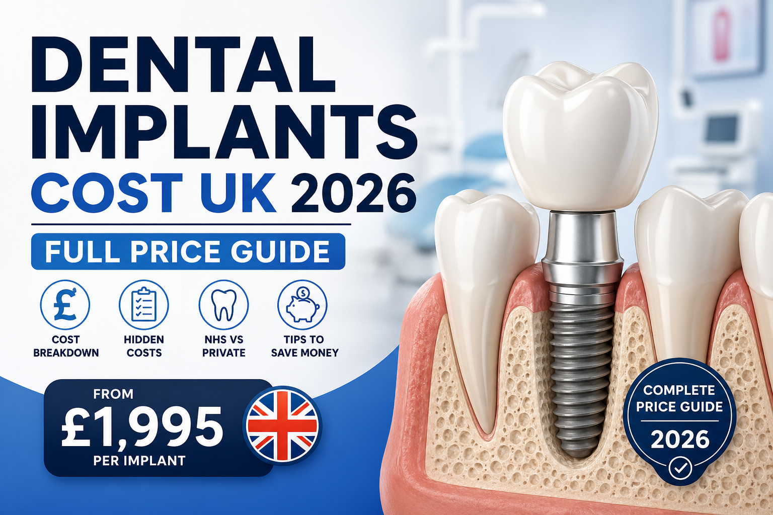 Dental Implants Cost UK 2026 Full Price Guide